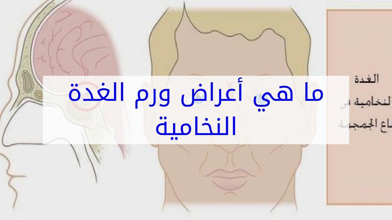 اعراض خمول الغدة النخامية - نتائج قصور الغدة النخامية 3926