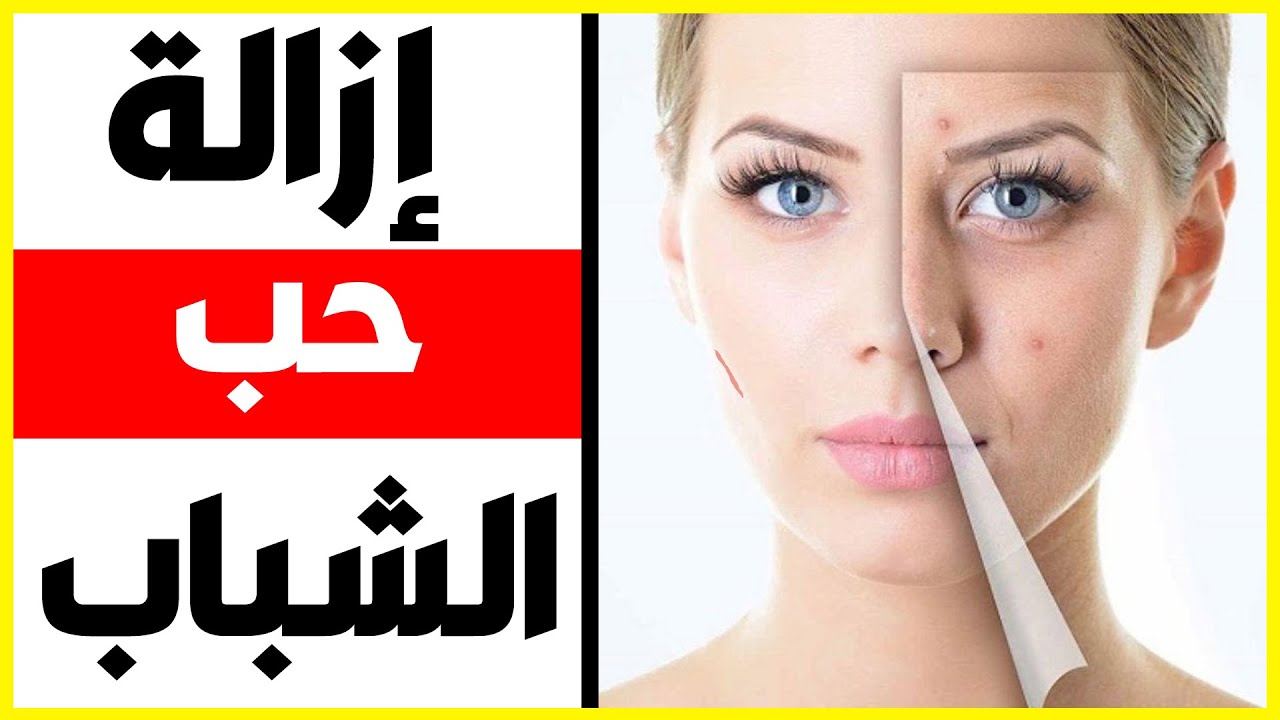 اضرار علاج حب الشباب بالليزر - هل الليزر يكون ضار 6685