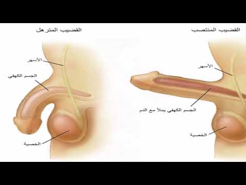 علاج عدم الاحساس بالعضو الذكري - ما هي اسباب عدم الاحساس بالقضيب 1776 1