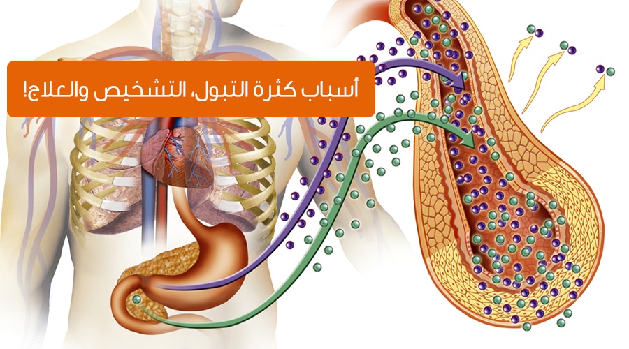 علاج التبول الكثير , كيفيه التخلص من مشكله كثره التبول