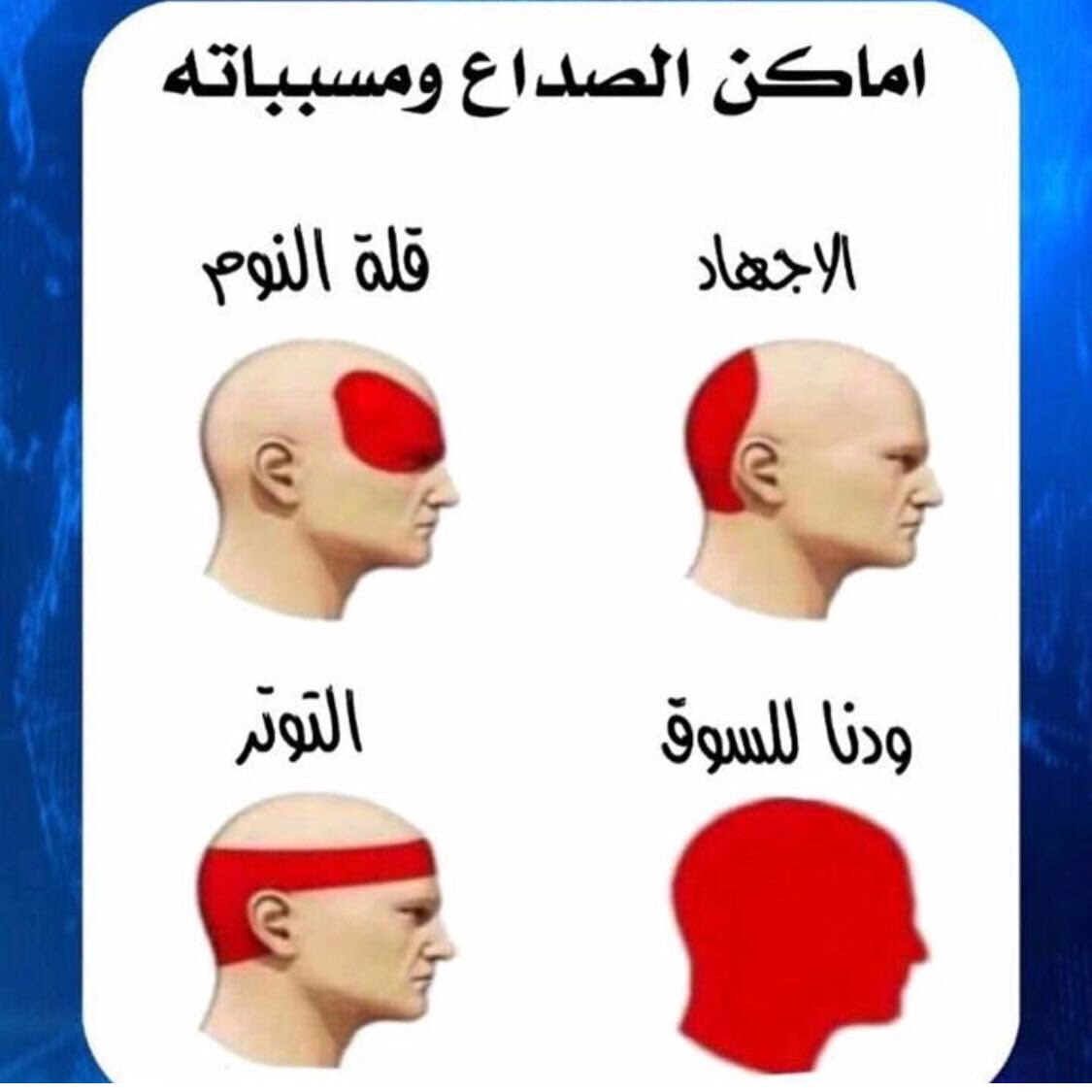 أسباب الصداع , اهم طرق لعلاج الصداع