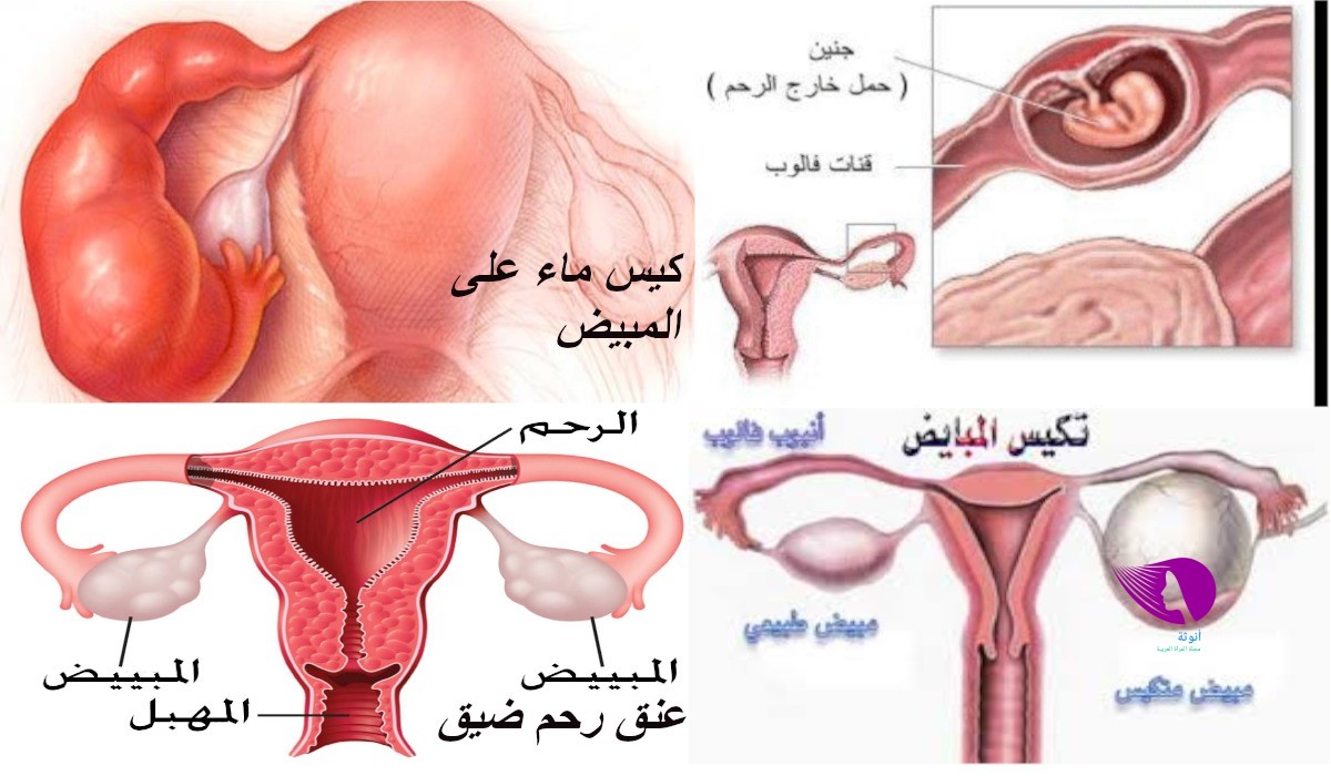 اسباب تاخر الحمل - اسباب عدم حدوث الحمل 2991 2