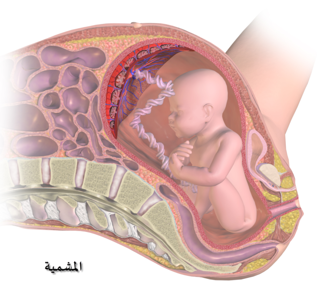 اعراض المشيمة النازلة , ماهو علاج المشيمة النازلة عند الحامل