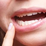 علاج التهاب الفم واللثة